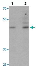 Anti-POU3F2 Rabbit Polyclonal Antibody