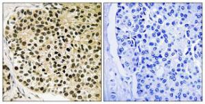 Anti-NFATC4 Rabbit Polyclonal Antibody