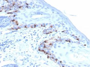 Immunohistochemical analysis of formalin-fixed, paraffin-embedded human skin using Anti-MelanA Antibody [rMLANA/4576]