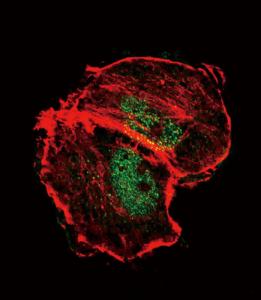 Anti-TSC2 Rabbit Polyclonal Antibody (AP (Alkaline Phosphatase))