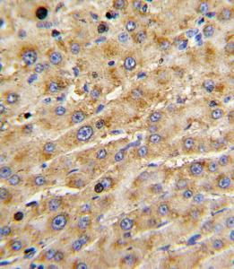 Anti-ADAMTS13 Rabbit Polyclonal Antibody