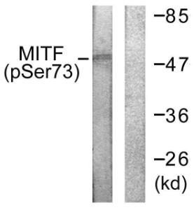 Western blot analysis of lysates from COS7 cells using Anti-MITF (phospho Ser180 + Ser73) Antibody. The right hand lane represents a negative control, where the antibody is blocked by the immunising peptide