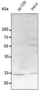 HeLa and AtT-20 cell lysates detected with Anti-RAB11A Antibody at a 1:2,500 dilution Lysates at 100 µg per lane and rabbit anti-goat IgG antibody (HRP) at a 1:10,000 dilution