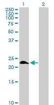 Anti-RAB9A Rabbit Polyclonal Antibody