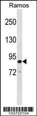 Anti-ARHGAP26 Rabbit Polyclonal Antibody (HRP (Horseradish Peroxidase))