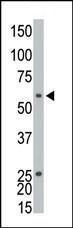 Anti-ETNK1 Rabbit Polyclonal Antibody (PE (Phycoerythrin))