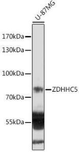 Western blot analysis of extracts of U-87MG cells, using Anti-DHHC-5 Antibody (A305849) at 1:1000 dilution