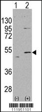 Anti-ALDH5A1 Rabbit Polyclonal Antibody