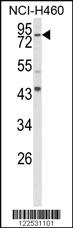 Anti-SLC15A1 Rabbit Polyclonal Antibody