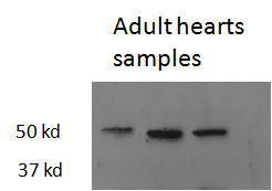 Anti-thrb Antibody (A82504) (2.5 µg/ml) staining of Zebrafish adult Heart lysate (35 µg protein in RIPA buffer). Primary incubation was 1 hour. Detected by chemiluminescence