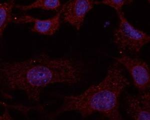 NHI/3T3 cells, fixed with methanol and permeabilized with 01% Saponin, stained with Anti-RAB11A Antibody at a 1:100 dilution