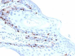 Immunohistochemical analysis of formalin-fixed, paraffin-embedded human skin using Anti-MelanA Antibody [rMLANA/4576]