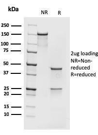 SDS-PAGE analysis of Anti-MCM7 Antibody [rMCM7/1468] under non-reduced and reduced conditions; showing intact IgG and intact heavy and light chains, respectively. SDS-PAGE analysis confirms the integrity and purity of the antibody