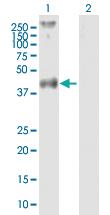 Anti-F2R Mouse Polyclonal Antibody