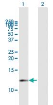 Anti-CDK2AP1 Mouse Polyclonal Antibody