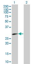 Anti-UBE2E3 Mouse Polyclonal Antibody