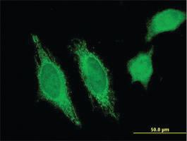 Anti-HHLA3 Mouse Monoclonal Antibody [clone: 1F6]