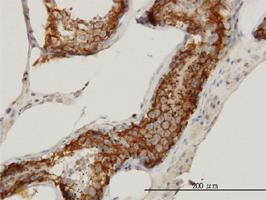 Anti-FATE1 Mouse Monoclonal Antibody [clone: 3B1]