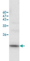 Anti-MYL3 Rabbit Polyclonal Antibody