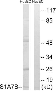 Antibody anti-S100A7L2 A99949-100 100 µg