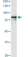 Anti-SCYL3 Polyclonal Antibody Pair