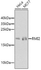 Western blot analysis of extracts of various cell lines, using Anti-RMI2 Antibody (A10445) at 1:1,000 dilution. The secondary antibody was Goat Anti-Rabbit IgG H&L Antibody (HRP) at 1:10,000 dilution.