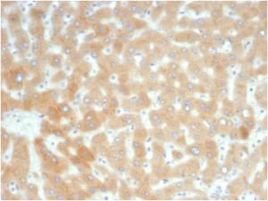 Immunohistochemical analysis of formalin-fixed, paraffin-embedded human kidney tissue using Anti-RBP4 Antibody [RBP4/7045R]