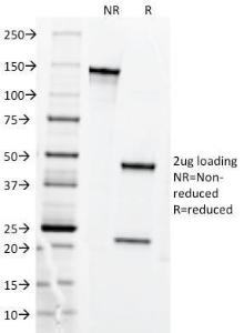 SDS-PAGE analysis of Anti-Transferrin Receptor Antibody [DF1513] under non-reduced and reduced conditions; showing intact IgG and intact heavy and light chains, respectively SDS-PAGE analysis confirms the integrity and purity of the antibody