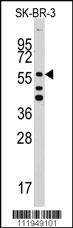 Anti-TAS1R2 Rabbit Polyclonal Antibody