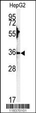 Anti-TRIM73 Rabbit Polyclonal Antibody