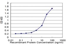 Anti-UBE2E3 Mouse Monoclonal Antibody [clone: 4C4]