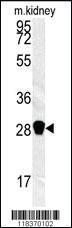 Anti-TRIM73 Rabbit Polyclonal Antibody