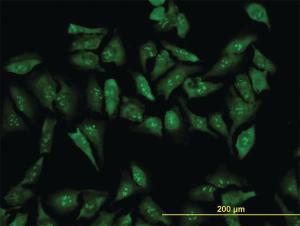 Anti-RPL19 Mouse Monoclonal Antibody [clone: 3H4]