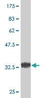 Anti-POMGNT1 Mouse Monoclonal Antibody [clone: 6C12]