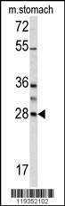 Anti-GZMB Rabbit Polyclonal Antibody