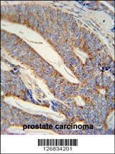 Anti-DACT1 Rabbit Polyclonal Antibody (APC (Allophycocyanin))