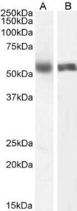 Anti-Cyp1a2 Antibody (A82506) (0.5 µg/ml) staining of Human Liver (A) and (1 µg/ml) Lung (B) lysate (35 µg protein in RIPA buffer). Primary incubation was 1 hour. Detected by chemilu minescence