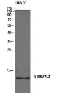 Antibody anti-S100A7L2 A99949-100 100 µg