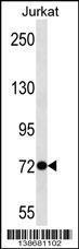 Anti-SOWAHB Rabbit Polyclonal Antibody (FITC (Fluorescein Isothiocyanate))