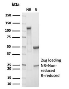 SDS-PAGE analysis of Anti-RBP4 Antibody [RBP4/7045R] under non-reduced and reduced conditions; showing intact IgG and intact heavy and light chains, respectively. SDS-PAGE analysis confirms the integrity and purity of the antibody