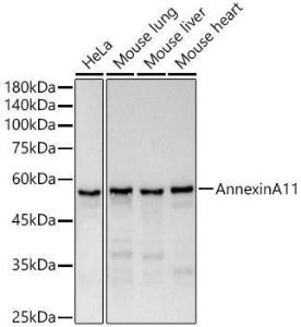 Western blot analysis of various lysates, using Anti-Annexin-11/ANXA11 Antibody [ARC51481] (A305850) at 1:1000 dilution. The secondary Antibody was Goat Anti-Rabbit IgG H&L Antibody (HRP) at 1:10000 dilution. Lysates/proteins were present at 25 µg per lane