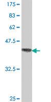 Anti-ATXN2 Mouse Polyclonal Antibody