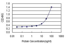 Anti-IGFBP2 Polyclonal Antibody Pair