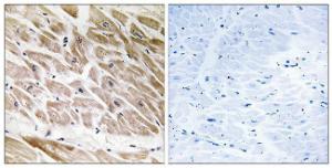 Immunohistochemical analysis of paraffin-embedded human heart tissue using Anti-RHG1 Antibody The right hand panel represents a negative control, where the antibody was pre-incubated with the immunising peptide