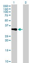 Anti-CRHBP Mouse Polyclonal Antibody