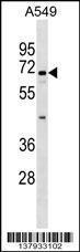 Anti-ITFG1 Rabbit Polyclonal Antibody (HRP (Horseradish Peroxidase))