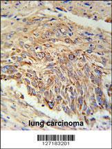 Anti-EBPL Rabbit Polyclonal Antibody (HRP (Horseradish Peroxidase))