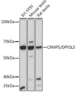 Western blot analysis of extracts of various cell lines, using Anti-CRMP5 Antibody [ARC2020] (A308547) at 1:1000 dilution