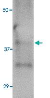 Anti-HA1 Mouse Monoclonal Antibody [clone: 4E11E1]