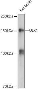 Western blot analysis of extracts of Rat brain, using Anti-ULK1 Antibody (A10448) at 1:500 dilution